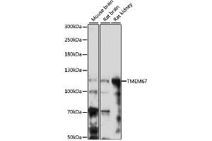 Western blot analysis of extracts of various cell lines, using TMEM67 antibody (ABIN6293383) at 1:1000 dilution.