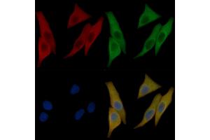 alpha-Actinin Mouse Monoclonal Antibody staining Hela cells by IF/ICC. (alpha Actinin Antikörper  (Internal Region))