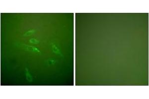 Immunofluorescence analysis of HeLa cells, using Collagen III Antibody. (COL3 Antikörper  (AA 81-130))
