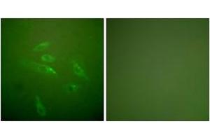 Immunofluorescence analysis of HeLa cells, using Collagen III Antibody. (COL3 Antikörper  (AA 81-130))