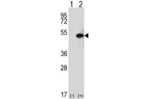Western Blotting (WB) image for anti-Sphingosine Kinase 1 (SPHK1) (AA 313-343) antibody (ABIN3032708)