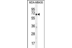 KCNQ1 Antibody (N-term) (ABIN656077 and ABIN2845424) western blot analysis in MDA-M cell line lysates (35 μg/lane). (KCNQ1 Antikörper  (N-Term))