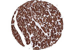 anti-Myosin Heavy Chain 7, Cardiac Muscle, beta (MYH7) (AA 1100-1360) antibody