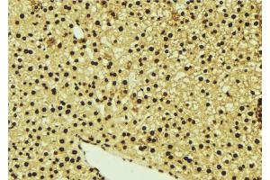 ABIN6277078 at 1/100 staining Mouse liver tissue by IHC-P. (LYN Antikörper  (C-Term))