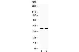 Western blot testing of human 1) HeLa and 2) A549 cell lysate with Annexin VIII antibody at 0. (Annexin VIII Antikörper  (AA 20-61))