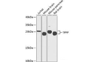 Western blot analysis of extracts of various cell lines using TPPP Polyclonal Antibody at dilution of 1:1000. (Tppp Antikörper)