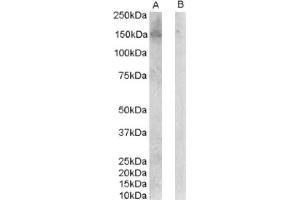 Image no. 1 for anti-Receptor Tyrosine-Protein Kinase ErbB-3 (ERBB3) (C-Term), (Isoform 1) antibody (ABIN374599)
