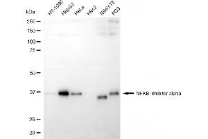 Western blotting analysis using NFKB inhibitor alpha antibody (ABIN7799642).