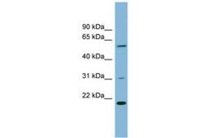 Image no. 1 for anti-TP53RK Binding Protein (TPRKB) (AA 35-84) antibody (ABIN6742046) (TPRKB Antikörper  (AA 35-84))