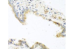 Immunohistochemistry of paraffin-embedded Mouse lung using RETN Polyclonal Antibody at dilution of 1:100 (40x lens). (Resistin Antikörper)