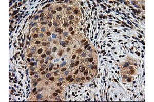 Image no. 7 for anti-EPM2A (Laforin) Interacting Protein 1 (EPM2AIP1) antibody (ABIN1498046) (EPM2AIP1 Antikörper)