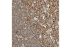 Immunohistochemical analysis of TFCP2L1 in rat colon tissue with TFCP2L1 polyclonal antibody  at 2. (TFCP2L1 Antikörper  (N-Term))