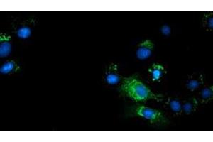 Anti-TCP11L2 mouse monoclonal antibody (ABIN2453720) immunofluorescent staining of COS7 cells transiently transfected by pCMV6-ENTRY TCP11L2 (RC207129). (TCP11L2 Antikörper)