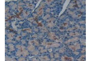 IHC-P analysis of Rat Pancreas Tissue, with DAB staining. (TNFRSF11A Antikörper  (AA 31-214))