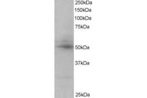 Western Blotting (WB) image for anti-CAMP Responsive Element Binding Protein 3-Like 4 (CREB3L4) (C-Term) antibody (ABIN2465555) (CREB3L4 Antikörper  (C-Term))