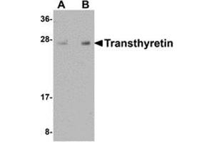 Western Blotting (WB) image for anti-Transthyretin (TTR) (Middle Region) antibody (ABIN1031141)