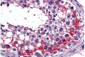 Human Testis: Formalin-Fixed, Paraffin-Embedded (FFPE) (TES Antikörper  (AA 1-422))