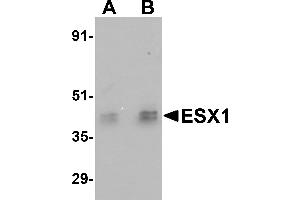 Western Blotting (WB) image for anti-ESX Homeobox 1 (ESX1) (Middle Region) antibody (ABIN1030926)