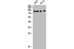 Western Blot analysis of various cells using Antibody diluted at 1:1000. (IL4 Receptor Antikörper  (Internal Region))