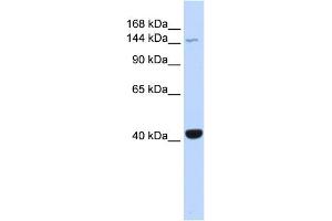 WB Suggested Anti-JAK3 Antibody Titration: 0. (JAK3 Antikörper  (Middle Region))