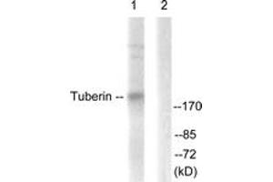 Western blot analysis of extracts from 293 cells, treated with Anisomycin 25ug/ml 30', using Tuberin/TSC2 (Ab-939) Antibody. (Tuberin Antikörper  (AA 905-954))