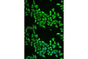 Immunofluorescence analysis of U2OS cells using MRPS30 antibody. (MRPS30 Antikörper  (AA 190-439))
