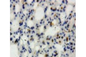 Used in DAB staining on fromalin fixed paraffin-embedded Lung tissue (Lipocalin 2 Antikörper  (AA 21-200))