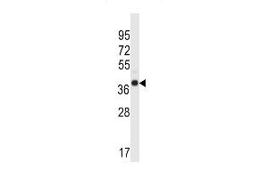 WDR89 Antibody (C-term) (ABIN657331 and ABIN2846400) western blot analysis in human normal Uterus tissue lysates (35 μg/lane). (WDR89 Antikörper  (C-Term))