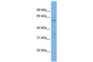 Image no. 1 for anti-Ubiquilin 4 (UBQLN4) (AA 287-336) antibody (ABIN6744179) (UBQLN4 Antikörper  (AA 287-336))