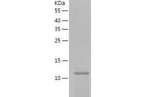 Western Blotting (WB) image for Ionized Calcium-binding Adapter Molecule 1 (IBA1) (AA 2-147) protein (His-IF2DI Tag) (ABIN7121795)
