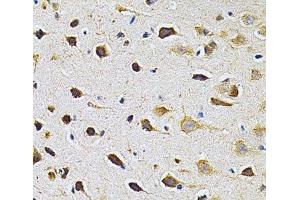 Immunohistochemistry of paraffin-embedded Rat brain using ADRBK1 Polyclonal Antibody at dilution of 1:200 (40x lens). (GRK2 Antikörper)