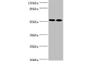 Western blot All lanes: Annexin A7 antibody at 4 μg/mL Lane 1: Jurkat whole cell lysate Lane 2: LO2 whole cell lysate Secondary Goat polyclonal to rabbit at 1/10000 dilution Predicted band size: 53, 51 kDa Observed band size: 53 kDa (Annexin VII Antikörper  (AA 259-488))
