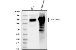 anti-A Kinase (PRKA) Anchor Protein 2 (AKAP2) (AA 813-852), (C-Term) antibody
