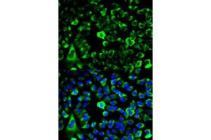 Immunofluorescence analysis of HeLa cells using RPS3 antibody (ABIN6290898). (RPS3 Antikörper)