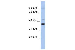 GADL1 antibody used at 1 ug/ml to detect target protein. (GADL1 Antikörper  (Middle Region))