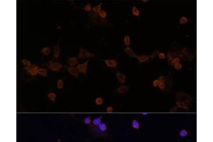 Immunofluorescence (IF) image for anti-Ubiquitin-Conjugating Enzyme E2L 3 (UBE2L3) antibody (ABIN7260980)