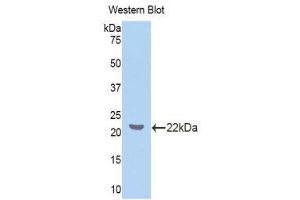 Western Blotting (WB) image for anti-Z-DNA Binding Protein 1 (ZBP1) (AA 10-167) antibody (ABIN1860971)