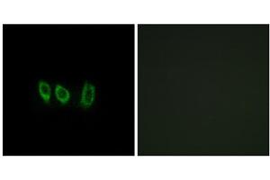 Immunofluorescence analysis of A549 cells, using CSTL1 antibody. (CSTL1 Antikörper  (Internal Region))