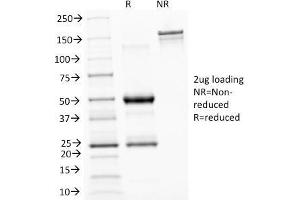 SDS-PAGE Analysis Purified ASRGL1 Mouse Monoclonal Antibody (CRASH/1289). (ASRGL1 Antikörper)