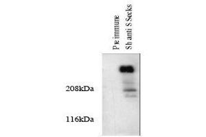 Image no. 1 for anti-A Kinase (PRKA) Anchor Protein 12 (AKAP12) antibody (ABIN296011) (AKAP12 Antikörper)