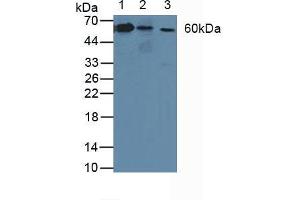 Figure. (ATP1B3 Antikörper  (AA 61-273))