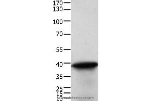 Western blot analysis of Human cervical cancer tissue, using TPM2 Polyclonal Antibody at dilution of 1:600