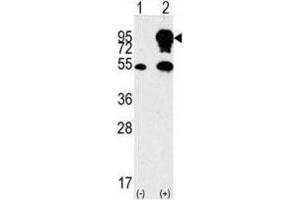 Western Blotting (WB) image for anti-Small Nuclear Ribonucleoprotein Polypeptide E (SNRPE) antibody (ABIN3003507)