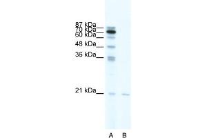WB Suggested Anti-SCAND1 Antibody Titration:  0. (SCAND1 Antikörper  (Middle Region))