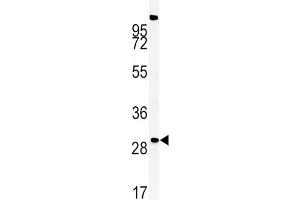Western blot analysis of ZDHHC21 Antibody (N-term) in mouse liver tissue lysates (35ug/lane). (ZDHHC21 Antikörper  (AA 59-87))