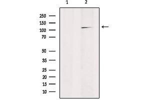 RANBP17 antibody  (N-Term)