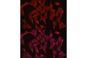 Immunofluorescence analysis of PC-12 cells using [KO Validated] Caspase-3 Rabbit pAb (ABIN6134639, ABIN6137978, ABIN6137979 and ABIN6215159) at dilution of 1:300 (40x lens). (Caspase 3 Antikörper  (AA 1-100))