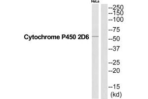 Western Blotting (WB) image for anti-Cytochrome P450, Family 2, Subfamily D, Polypeptide 6 (CYP2D6) (Internal Region) antibody (ABIN1852662) (CYP2D6 Antikörper  (Internal Region))