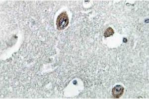 Immunohistochemistry (IHC) analyzes of NDUFB10 antibody in paraffin-embedded human brain tissue. (NDUFB10 Antikörper)