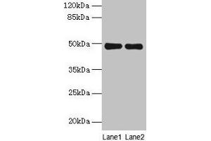 Western blot All lanes: MRPS5 antibody at 5 μg/mL Lane 1: Hela whole cell lysate Lane 2: Jurkat whole cell lysate Secondary Goat polyclonal to rabbit IgG at 1/10000 dilution Predicted band size: 49, 28 kDa Observed band size: 49 kDa